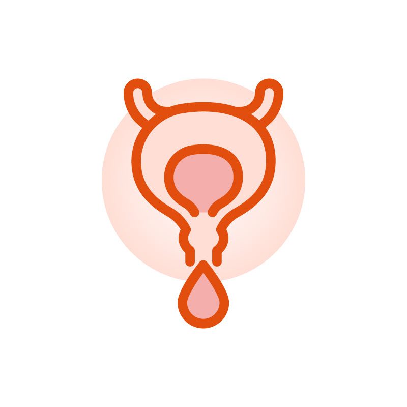 Resection Of Bladder Tumor Urólogos en Vallarta