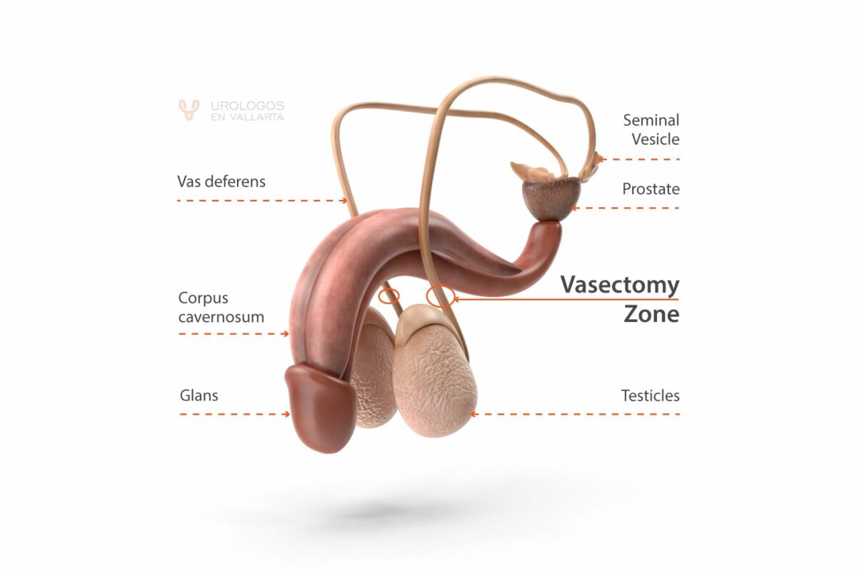 Vasectomy Zone